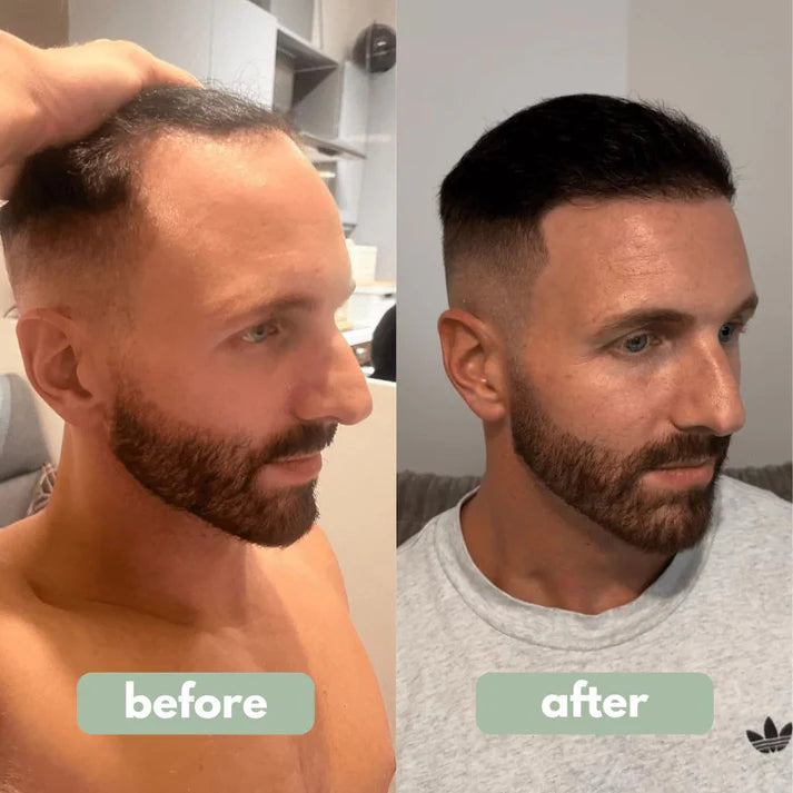 Be Bodywise™ Hair Growth Roll-On Serum